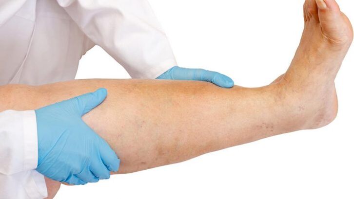 kako prepoznati bolezen